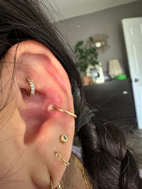 Why is there a bump on my earlobe after piercing 26