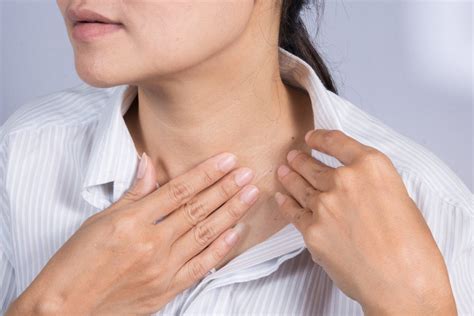 Бородавки у взрослых: виды и способы лечения | MedAboutMe