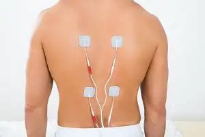 Spinal Cord Stimulator Cost
