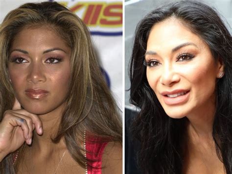 Did Nicole Scherzinger Just Have Plastic Surgery? - Demotix.com