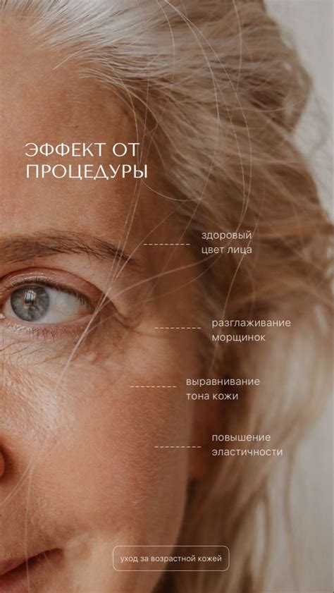 сторис для косметологии / скинбара в 2024 г | Косметолог, Ботокс губы, Лицо
