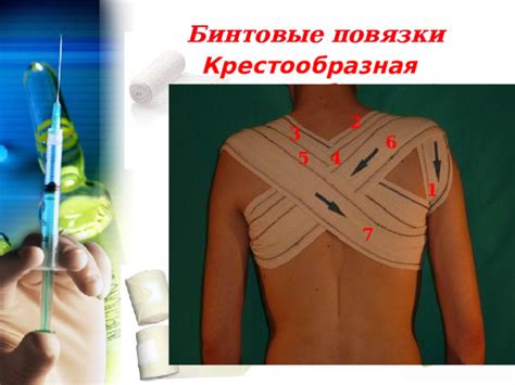 Виды повязок и правила наложения