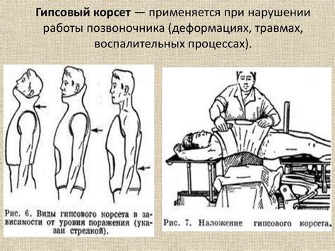 Современные оперативные и консервативные методы лечения переломов и ...