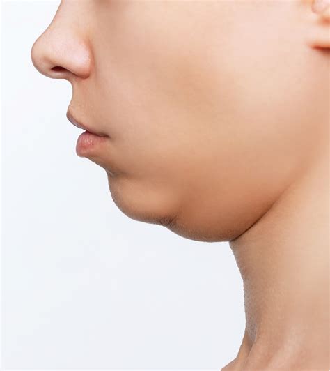 Jw Woodward: Before & After Results You Have To See To Believe! Image 20