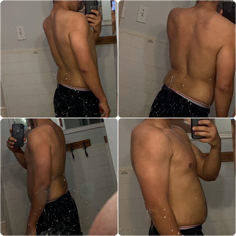 Back Bones Stick Out - Why There Is Two Bones Sticking Out Behind My