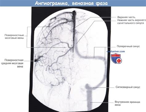 Вены и венозный отток от головного мозга