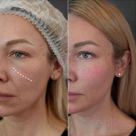 Клиника эстетической медицины и косметологии в Москве | Age Clinic