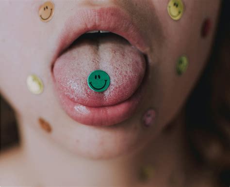black tongue in dogs due to deficiency of 1