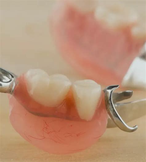 🦷 Prótesis parciales removibles | Clínica Dental Nobel - Clínica dental