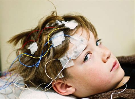5 types of seizures you need to know about