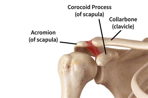Clavicle Fracture Treatment and Healing - Fracture Healing