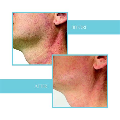 InfluencerGoneWild's Wildest Transformation: Before & After (Exclusive!) Image 7
