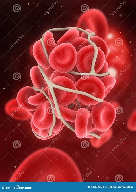 Blood Clot Brain Royalty-Free Cartoon | CartoonDealer.com #99725099