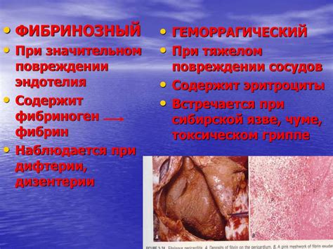 Воспаление. Причины воспаления - презентация онлайн