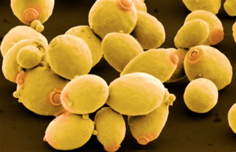 klasifikasi  morfologi khamir ilmu pengetahuan lengkap