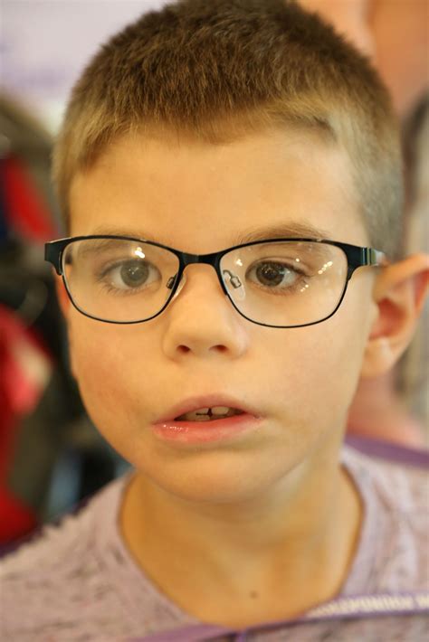 For Medical Professionals: Diagnosing Moebius Syndrome - Moebius