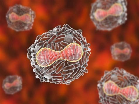 Smallpox: 10 Smallpox Symptoms