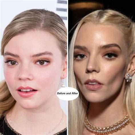 anya taylor joy    anya taylor joy star vrogueco