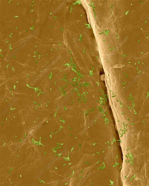 E. coli on the human skin surface, SEM - Stock Image - F017/4239 ...