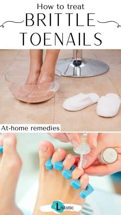 how to get clear healthy toenails