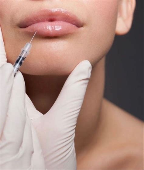 Lip Injections | Plastic surgery, Best eyebrow products, Lip injections