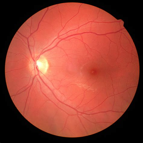 primarycareophthalmology.co.uk | ophthalmology courses