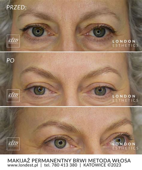 Brwi Permanentne Metody: Jakie Brwi Permanentne | LONDON ESTHETICS