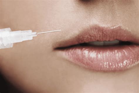 hyaluronic acid filler promises    swelling newbeauty
