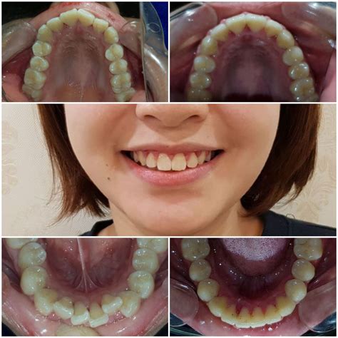 Dr. Dang Viet Khanh (orthodontist) - City Dental Clinic