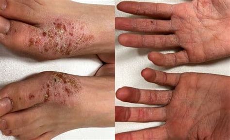 rash decisions dermatology case studies