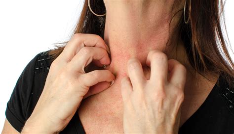 Hidradenitis Suppurativa: Current and Future Treatments
