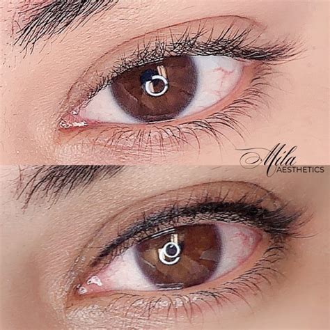 Eyeliner & Lash Line Enhancement | Mila Aesthetics