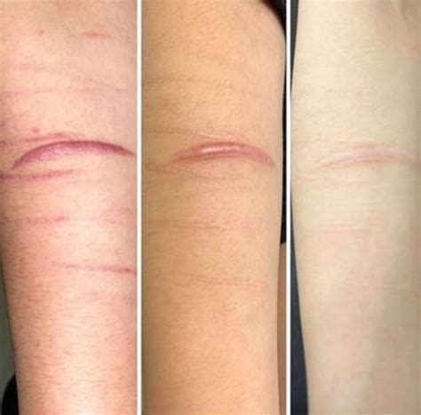 Beyond the Clicks: Katie Sigmond's Lasting Scars After the Leak - mey91j9