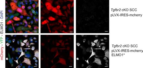 Figures and data in De-repression of the RAC activator ELMO1 in cancer ... 