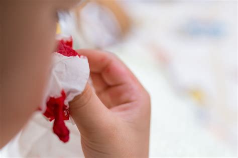 Носовые кровотечения у детей: как и чем помочь? | MedAboutMe