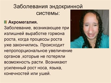 Эндокринная система - online presentation