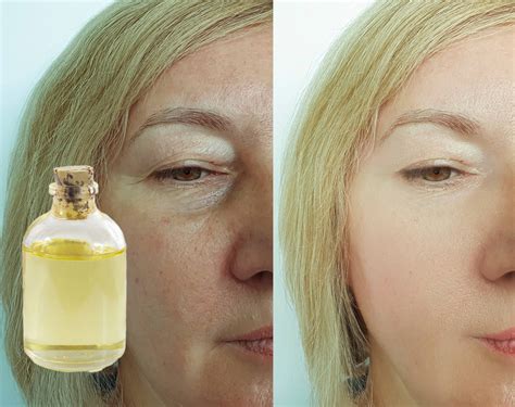 castor oil for face 4