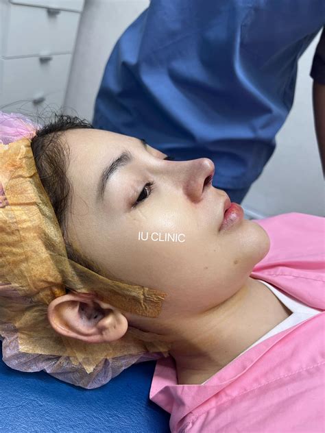 ขนาดบวมยังสวยขนาดนี้... - IU Clinic ไอยู คลินิก