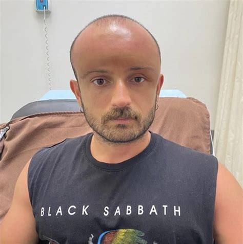 Man develops swollen head after day at the beach, stuns docs
