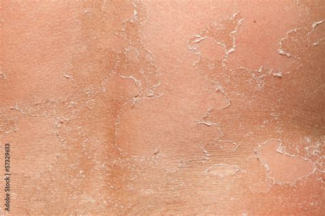 Part of peeling back Stock Photo | Adobe Stock