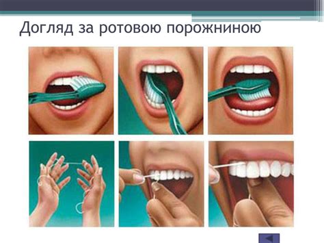 Презентація "Гігієна ротової порожнини"