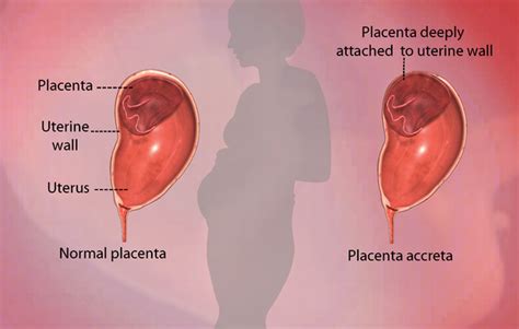 Health Condition : Symptoms, Causes, Treatment and More