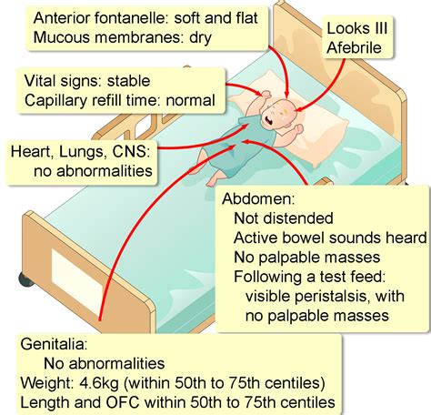 Hypertrophic Pyloric Stenosis - Interactive case study | Clinical ...