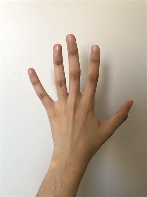 Why are my fingers like this? They are all a bit crooked : r/Anatomy