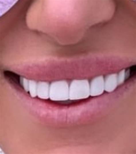 Lips look dry & crusty : r/KaleeFAKERogers
