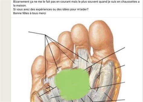 Douleurs sous le pied : quand le coureur ou le traileur doit s ...