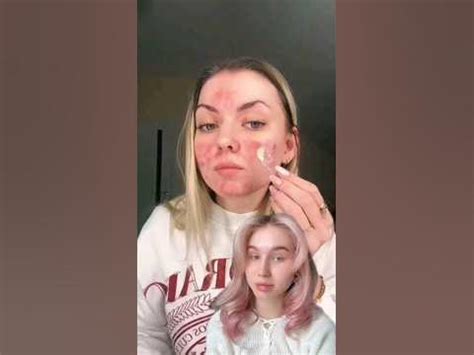 Как скрыть, покраснения, прыщи есть решение ️ #рекомендации #makeup # ...