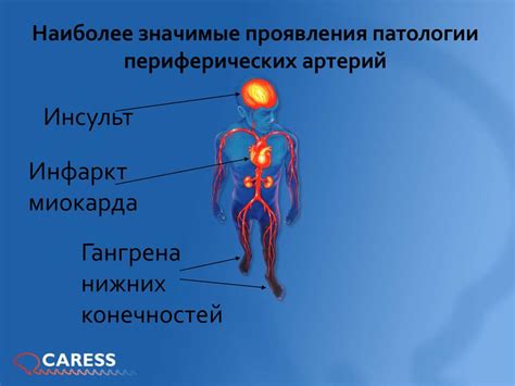 Нарушение артериального кровообращения нижних конечностей - презентация ...