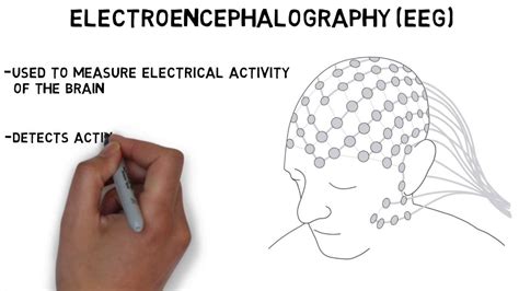 What is the full form of EEG?