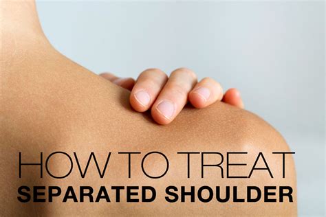 Shoulder Separation: Symptoms, Causes, Treatment By Shoulder Separation ...